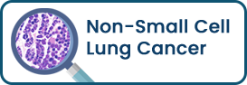 Non-small cell lung cancer