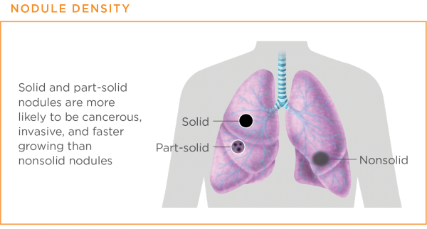 Nodule density