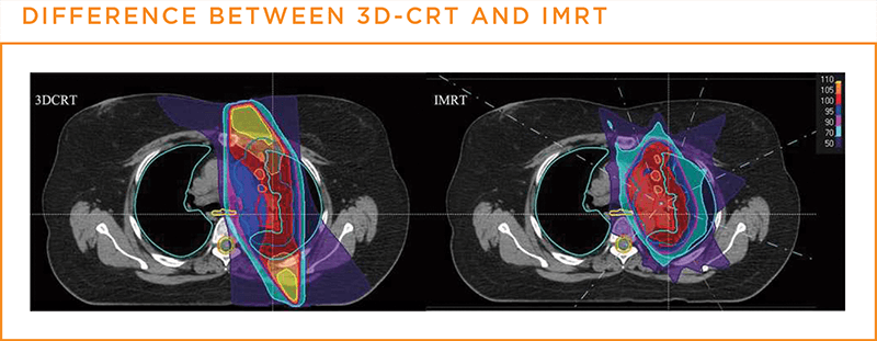 Difference between 3D CRT and IMRT