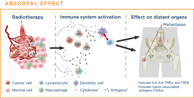 Abscopal effect