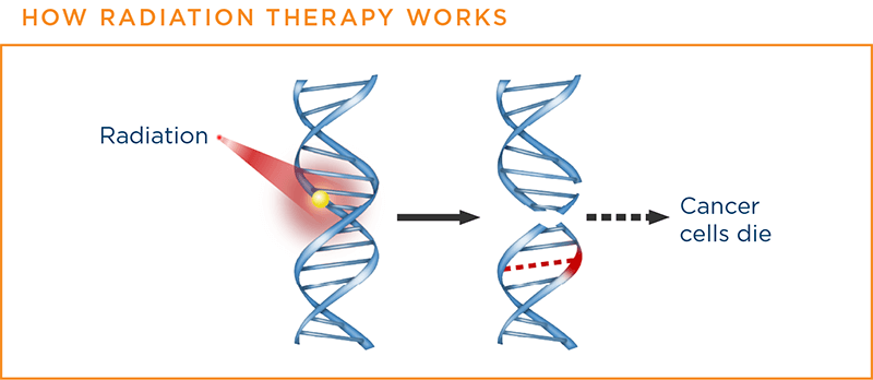 How radiation therapy works