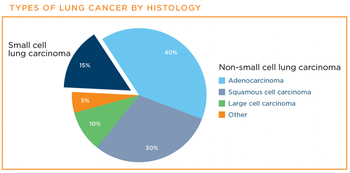 Pie chart showing types of lung cancer by histology
