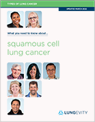 Squamous cell lung cancer brochure