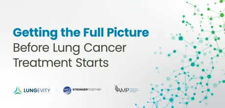 getting the full picture before lung cancer treatment starts