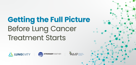 getting the full picture before lung cancer treatment starts