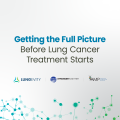 getting the full picture before lung cancer treatment starts